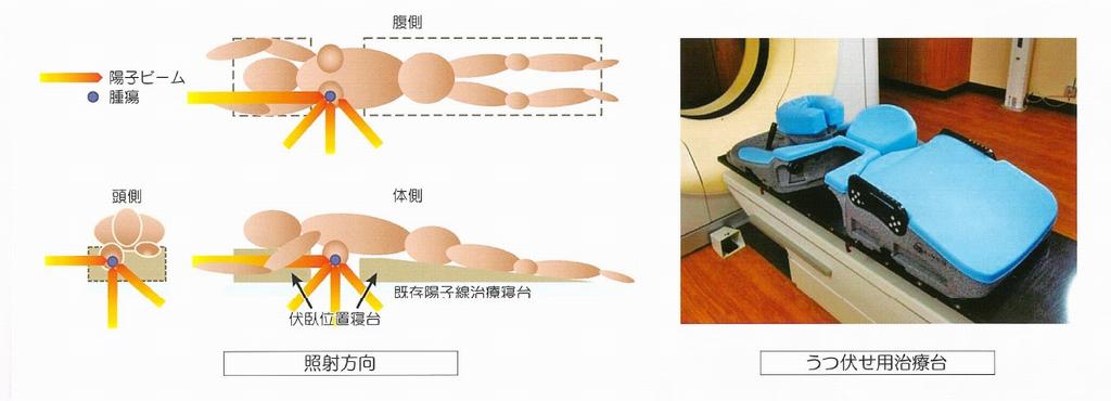 治療方法