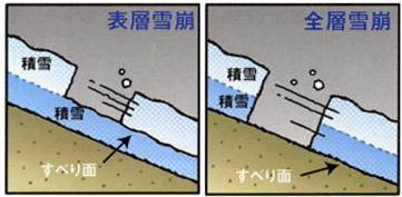 主な雪崩対策